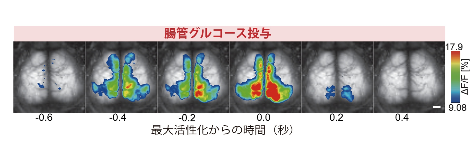 img-20250507-pr-sobun-02.png