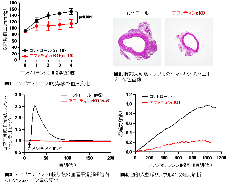 img-20250625-pr-sobun-01-04.png